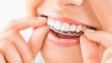 Know Everything About the Invisalign Cost Structure and Pricing Details in Kelowna